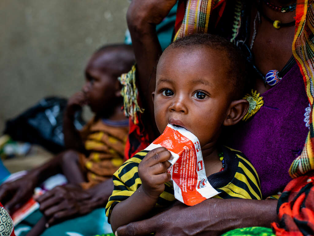 Ett barn får behandling mot undernäring i Tchad