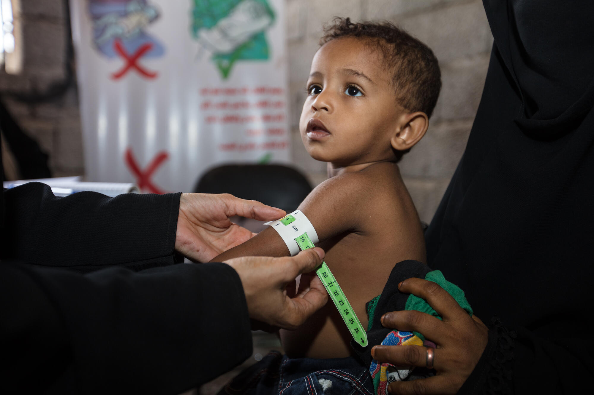 Ett barn får sin armomkrets mätt i Jemen under en undersökning för undernäring