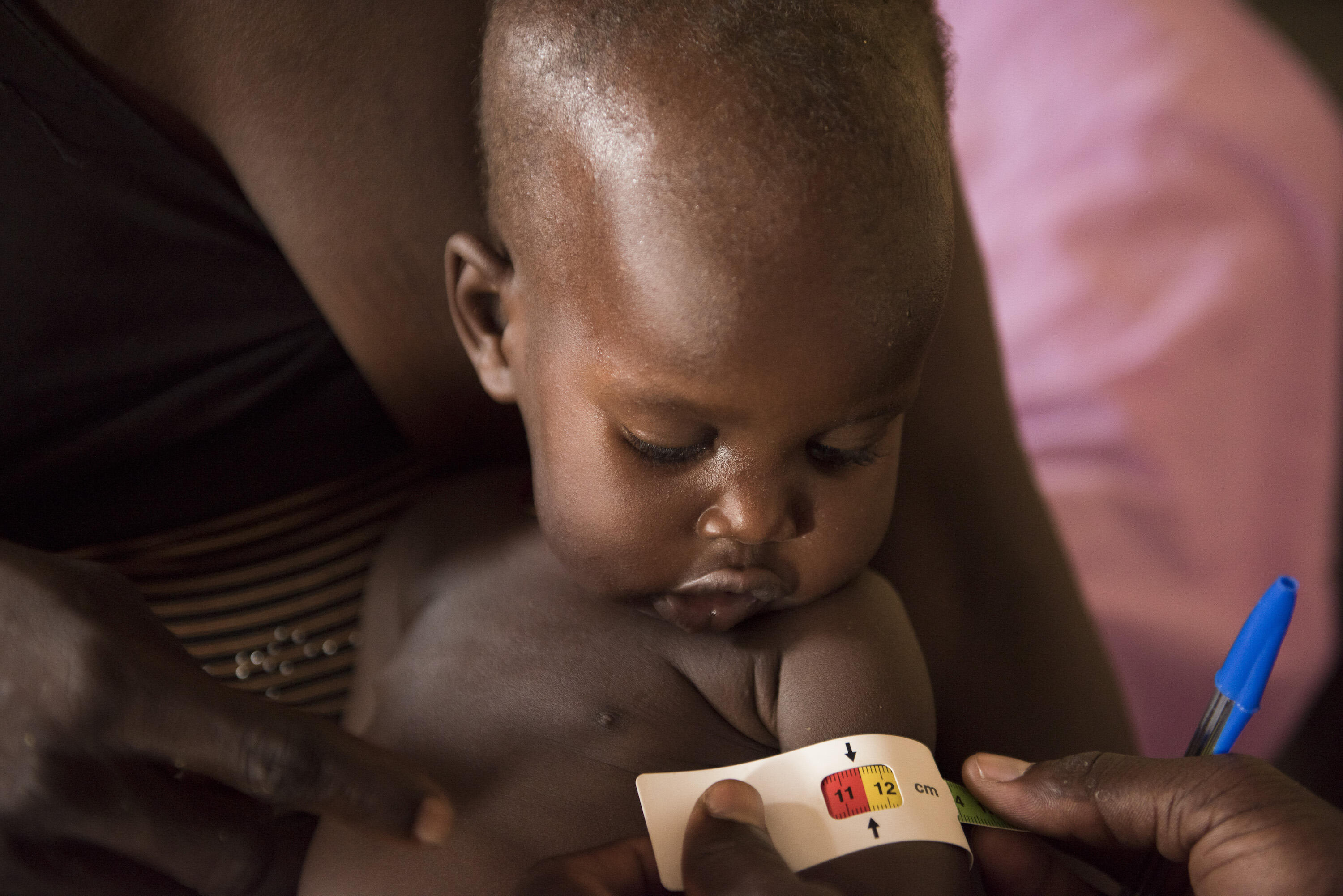 Barn undersökd för undernäring i Sydsudan av RESCUE