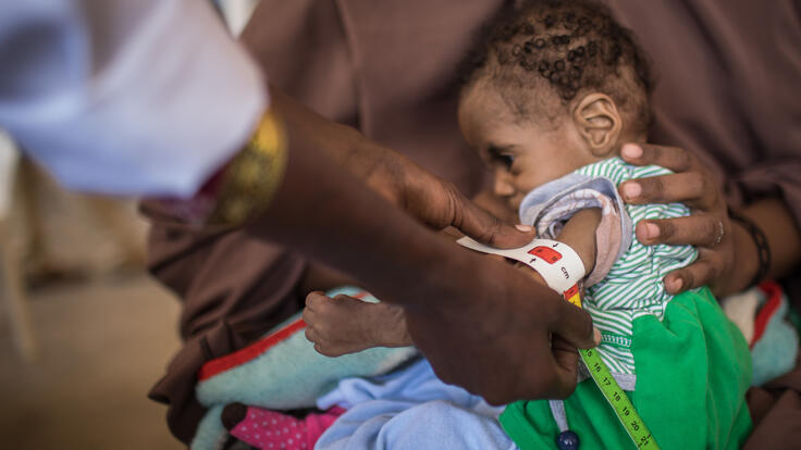 Ett litet barn blir undersökt för undernäring i Somalia